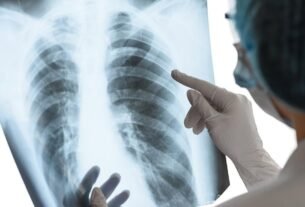 Casos de tuberculosis en México: ¿Cuáles Hjo los Síntomas?