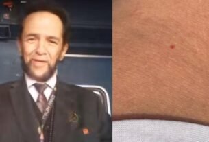 “Wolverine”, Director Del Metro, DA 3 Claves para Actuar ante Pinchazos en la Cdmx