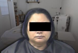 Botox Ilegal Deja A Mujer Con El Rostro Paralizado; Estafadora operaba en patio trasero