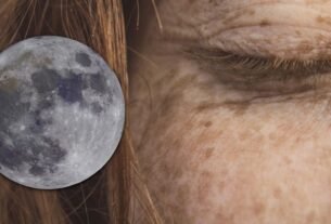 Who son los “niños de la luna” y cuál es la extraña enfermedad que los hace “alérgicos al sol”